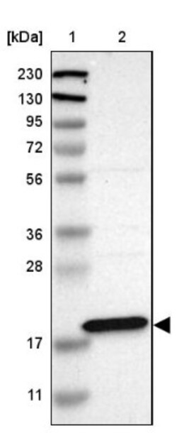 ANKRD22 Antibody, Novus Biologicals 25 &mu;L; Unlabeled:Antibodies, Polyclonal
